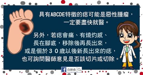 老二上有痣|我的「痣」會是惡性腫瘤嗎？醫師告訴你：符合這5特。